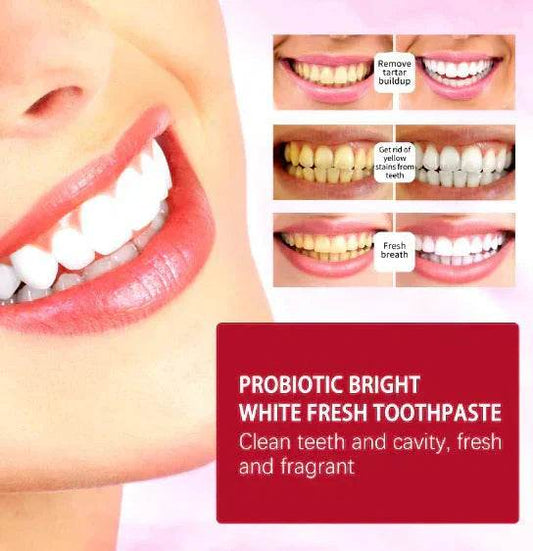 Sp-4 Toothpaste - My Store
