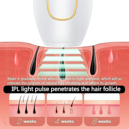 IPL Hair Removal Laser Epilator Women 🅱 - My Store