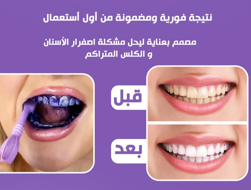 EELHOE PURPLE WHITENING TOOTHPASTE STAIN REMOVAL 🅱 - My Store