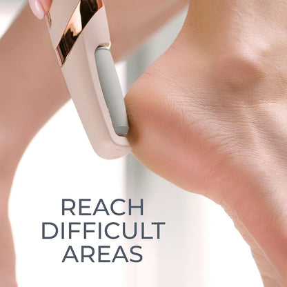 Feet Callus Remover 🅱 - My Store