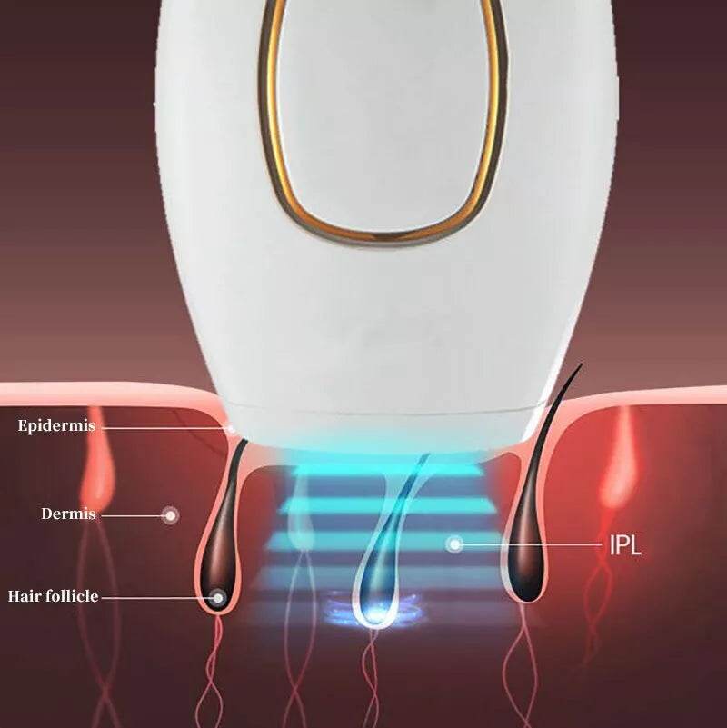 IPL Laser Hair Removal – جهاز إزالة الشعر بالليزر - My Store