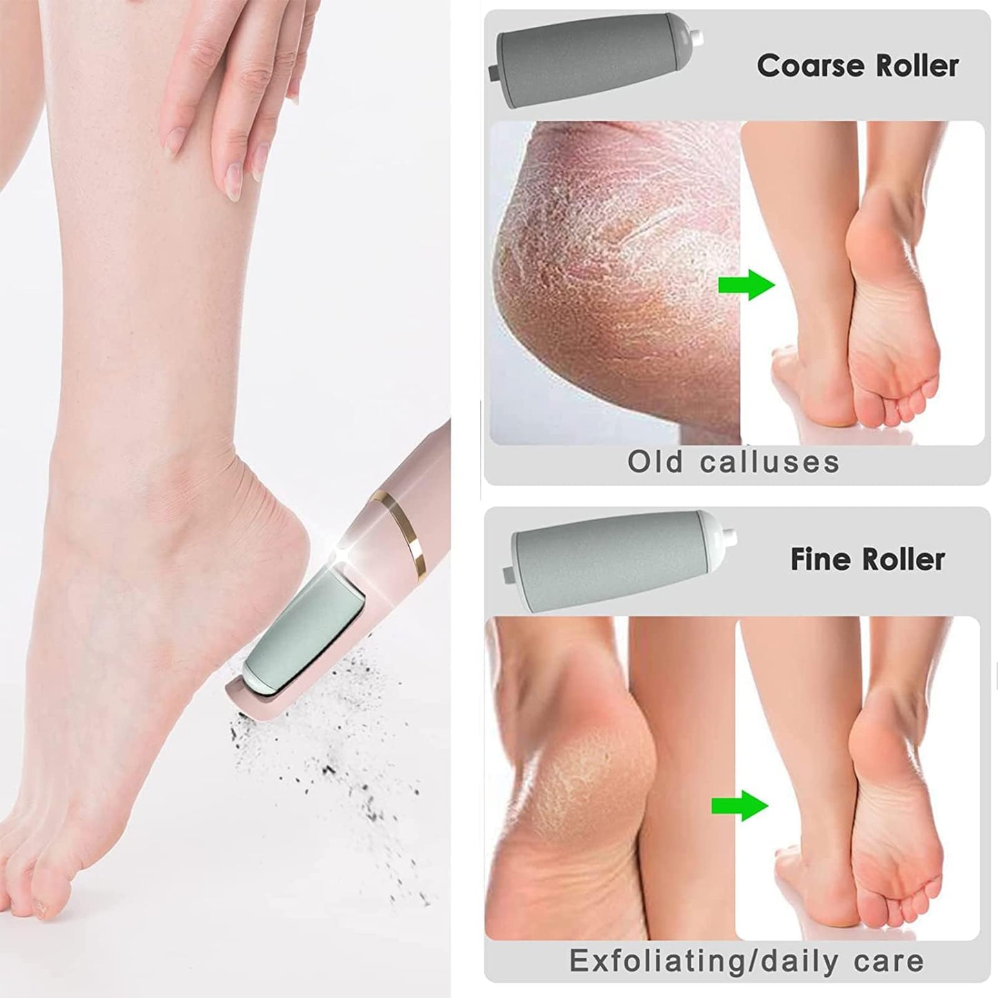 Feet Callus Remover 🅱 - My Store
