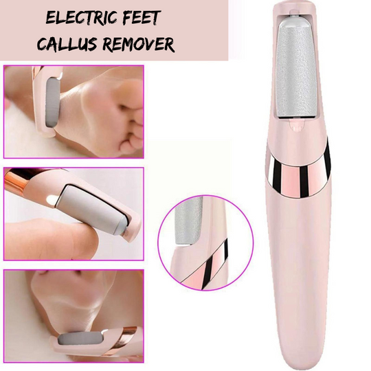 Feet Callus Remover 🅱 - My Store