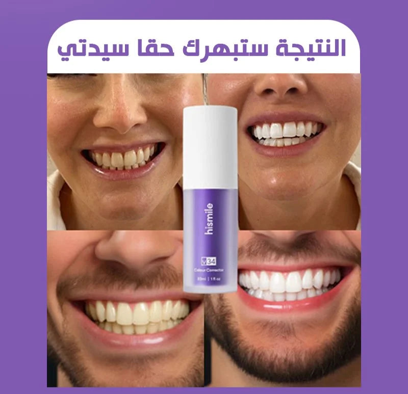 EELHOE PURPLE WHITENING TOOTHPASTE STAIN REMOVAL 🅱 - My Store